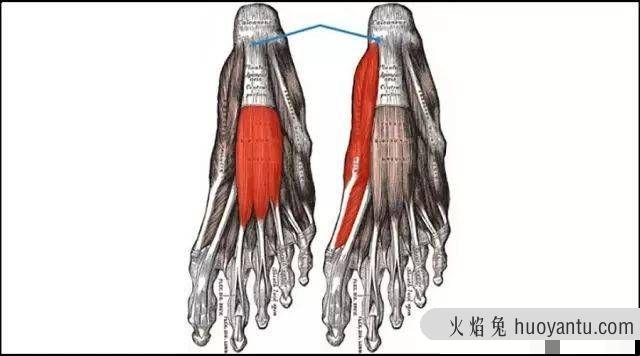 足底筋膜炎的预防、治疗和恢复，看这篇就够了