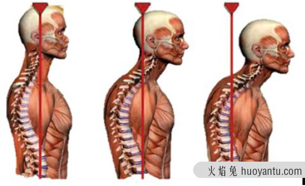 人老了为什么会驼背?老人驼背的原因有哪些