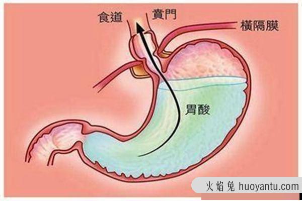 胃液为什么是酸性的?维持肠胃无菌环境(激活蛋白酶)