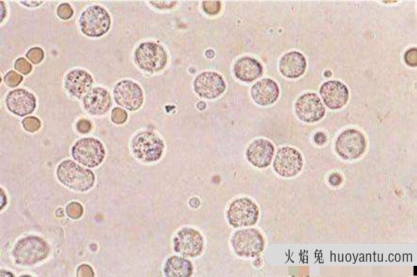 白细胞减少怎么回事?白细胞低吃什么补得快