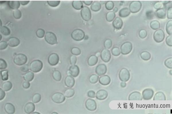 酵母可以用什么代替：做酒是无法替代的（其它用途可替代）