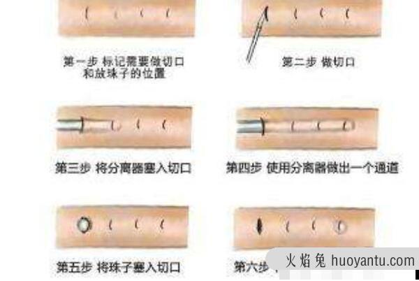 入珠是什么意思?男性的小弟弟镶嵌珠子(加强战斗力)