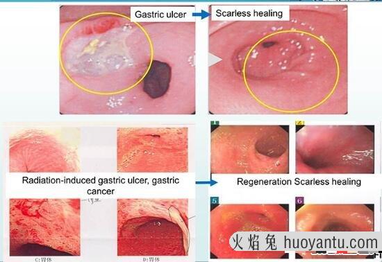 科学研究人体器官再生，缺胳膊少腿可以长复原(再生不再是梦)